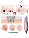 Aspirator Vacuum Facial Cleanser - Puncte Negre, Acnee, Pori