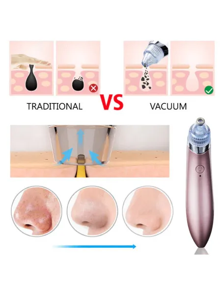 Aspirator Vacuum Facial Cleanser - Puncte Negre, Acnee, Pori
