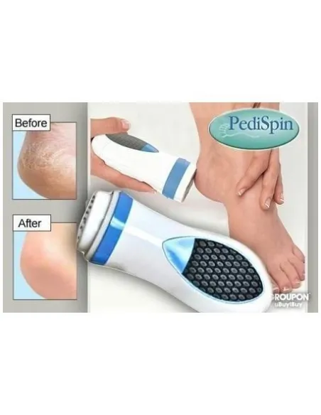 Aparat pentru intretinerea calcaielor