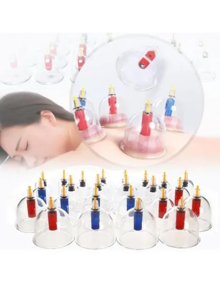 Set de 6 ventuze medicinale cu vacuum