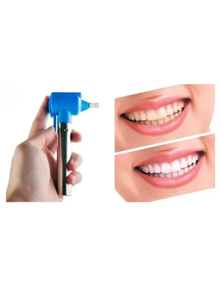 Aparat pentru albirea dintilor Luma Smile red-mag.ro