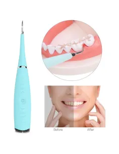 Dispozitiv electric pentru indepartarea depunerilor de tartru 2