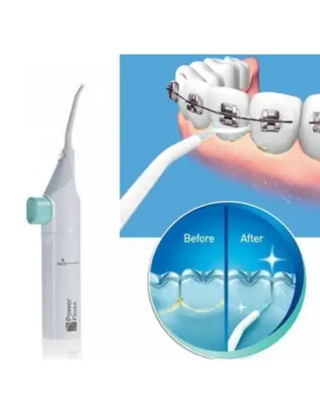 1+1 Gratis: Aparat curatare interdentara irigator