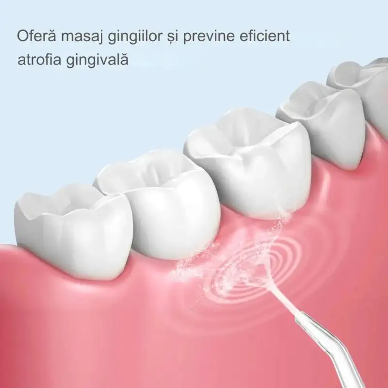 Irigator Bucal Portabil cu 3 Niveluri de Presiune, 4 Capete – Curățare 360° pentru Dinți și Gingii