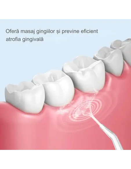Irigator Bucal Portabil cu 3 Niveluri de Presiune, 4 Capete – Curățare 360° pentru Dinți și Gingii