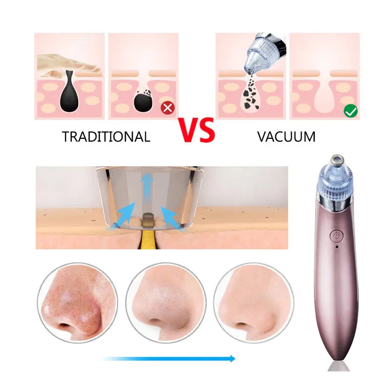 Aspirator Vacuum Facial Cleanser pentru Curățarea Tenului, Cosuri, Puncte Negre, Pori și Acnee