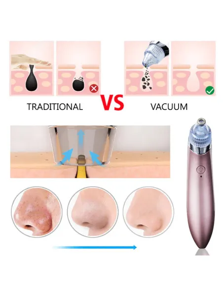 Aspirator Vacuum Facial Cleanser pentru Curățarea Tenului, Cosuri, Puncte Negre, Pori și Acnee