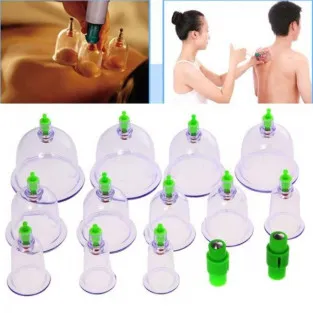Set de 12 ventuze medicinale terapeutice 2